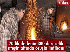 300 derecelik ateşin başında oruç!