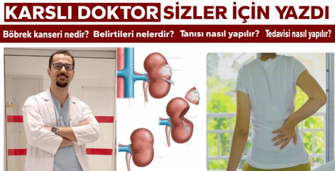 Karslı Doktor Sizler İçin Yazdı: Böbrek Kanseri..