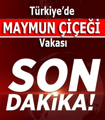 Türkiye'de İlk Maymun Çiçeği Vakası